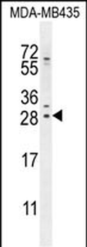 SELH Antibody (C-term)