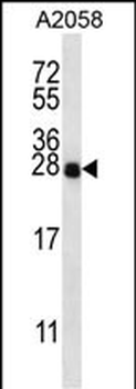 TMEM203 Antibody (C-term)