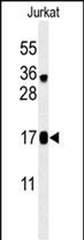 PRM3 Antibody (C-term)
