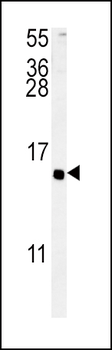ADCYAP1 Antibody (C-term)