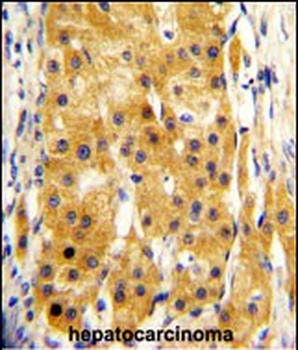 FMO1 Antibody (Center)