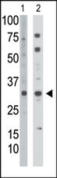 Thymidine Kinase 2 Antibody (C-term)