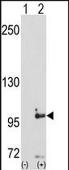 DDR1 Antibody (C-term)