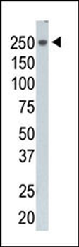 PI4KCA Antibody (N-term)