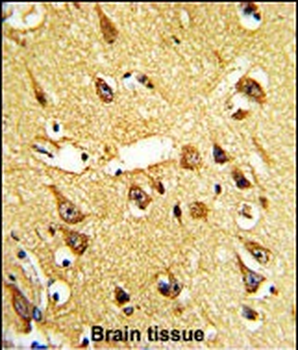 PI4KCA Antibody (N-term)