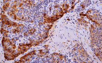 AFP Antibody
