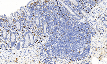 CD93 Antibody