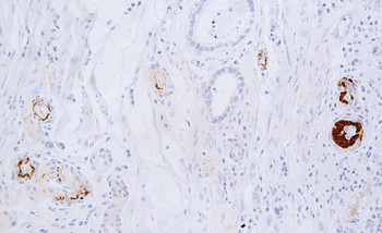 C4A Antibody