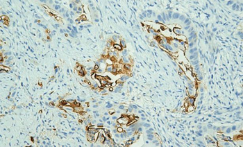ST6GALNAC6 Antibody