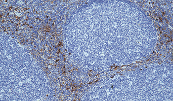 ANPEP Antibody