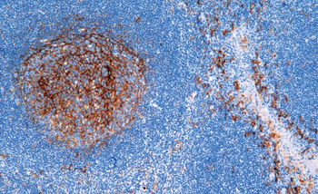 CD14 Antibody