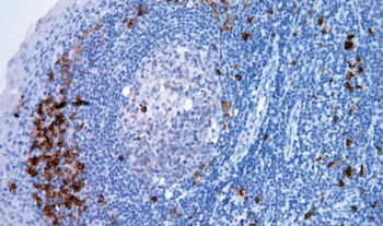 CD38 Antibody