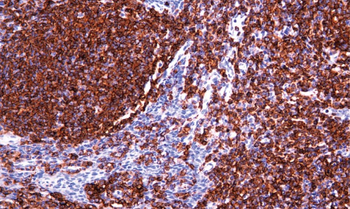 PTPRC Antibody