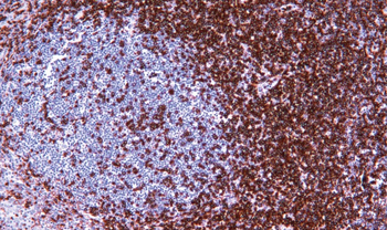PTPRC Antibody