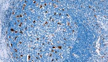 CD68 Antibody