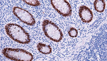 CDX2 Antibody