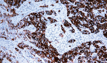 KRT6C Antibody