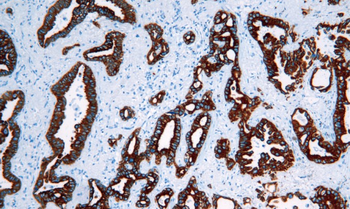 KRT7 Antibody