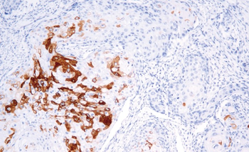 KRT10 Antibody