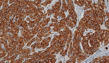 KRT16 Antibody