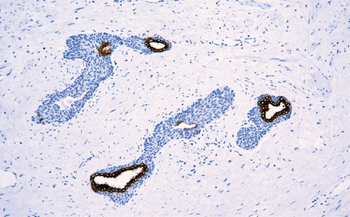 KRT18 Antibody