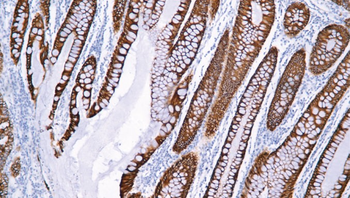 KRT19 Antibody