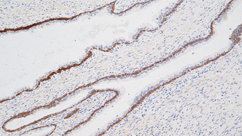 KRT76 Antibody