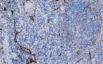 PDPN Antibody