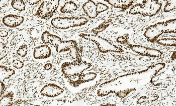 ERCC1 Antibody