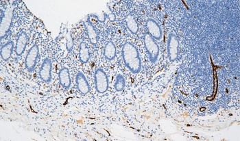 F8 Antibody