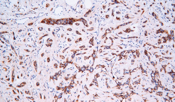 FTH1 Antibody
