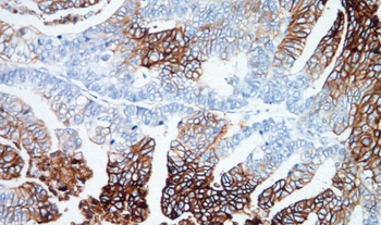 SLC2A1 Antibody