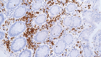 GYPA Antibody