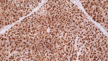 GP2 Antibody