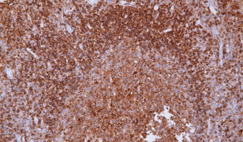 HLA-DRB1 Antibody