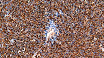 PMEL Antibody