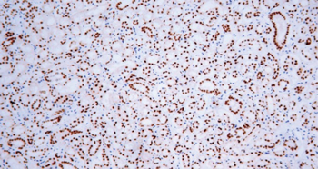 HNF1B Antibody