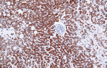 OXA1L Antibody