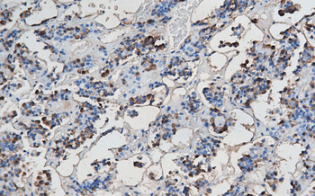 GH1 Antibody