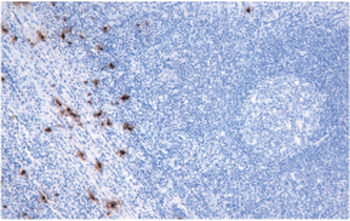 MCTS1 Antibody