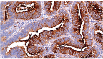 MUC1 Antibody