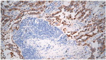 NAPSA Antibody