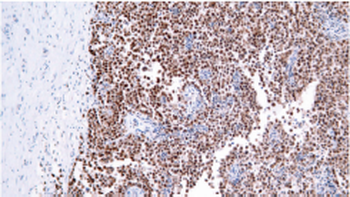 POU5F1 Antibody