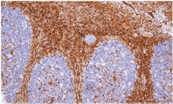 CDKN1B Antibody