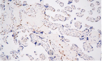 CDKN1C Antibody