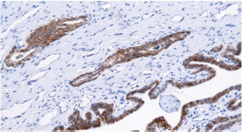 HNRNPU Antibody