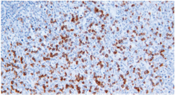 PDCD1 Antibody