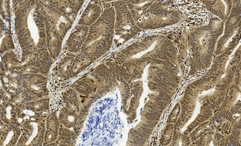 PTEN Antibody