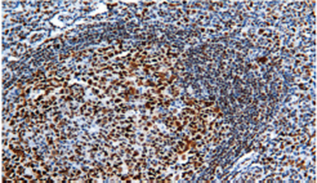 RB1 Antibody