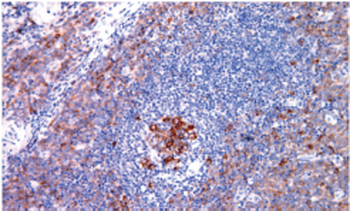 RRM1 Antibody